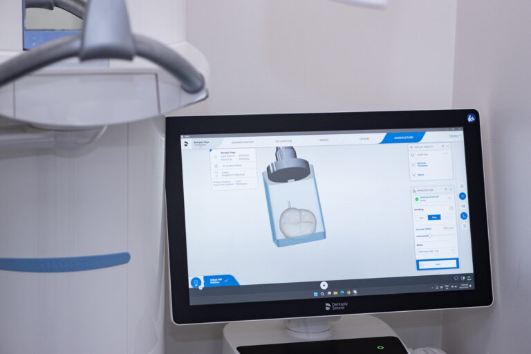 dental crown in geelong