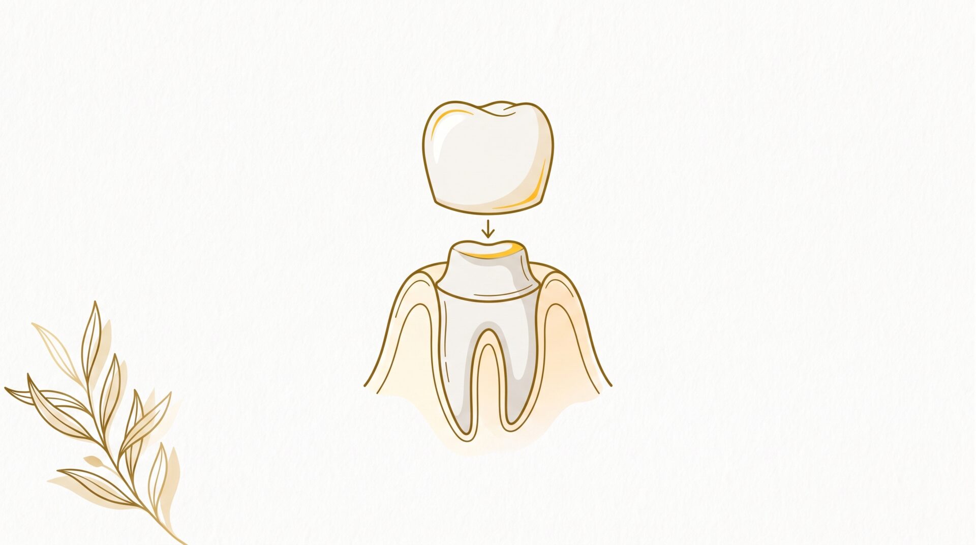 A dental crown hovers above a prepared tooth root, with a small olive branch accent in the corner.