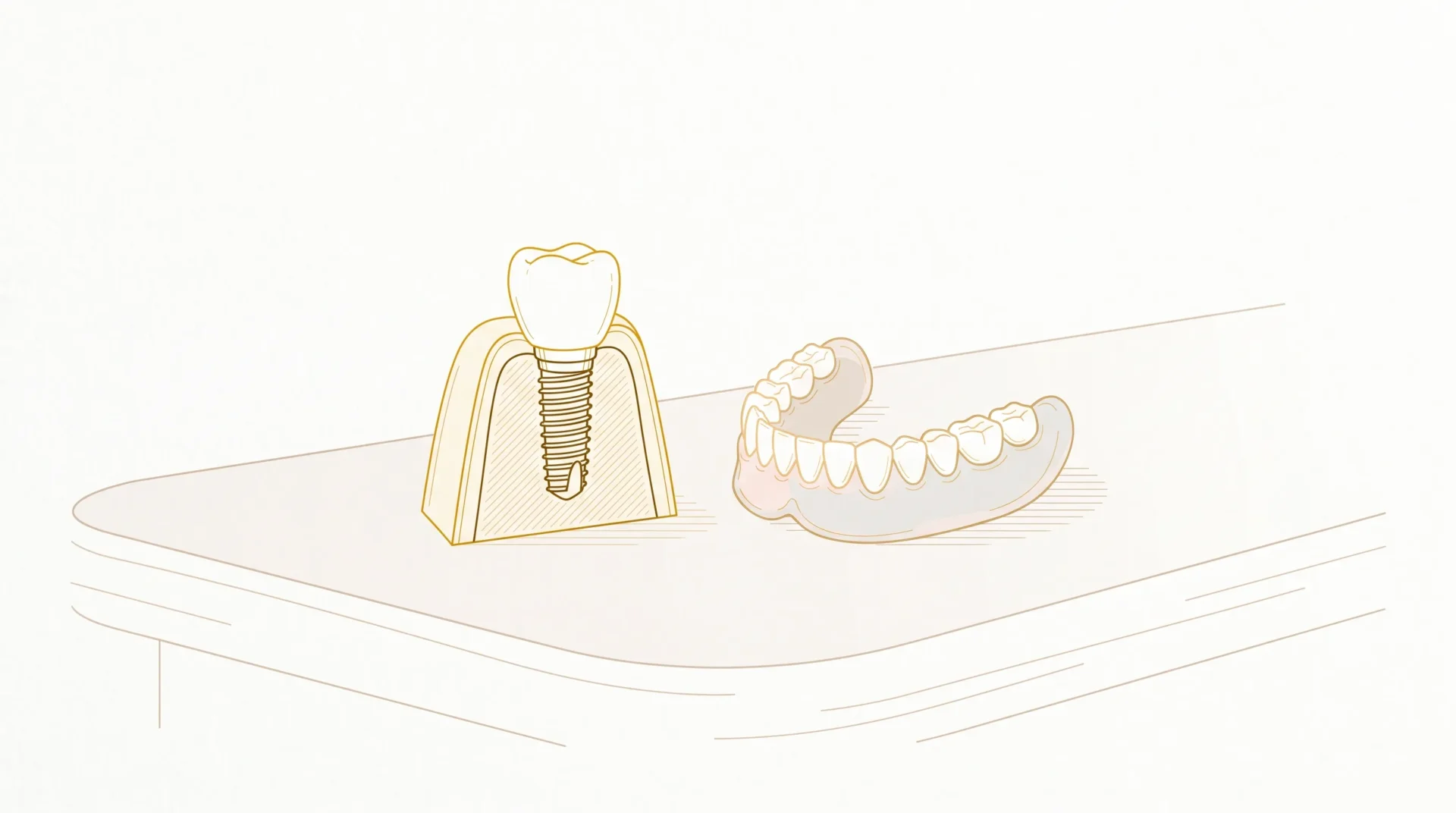 A dental implant model sits beside a removable denture on a clean tabletop for comparison.