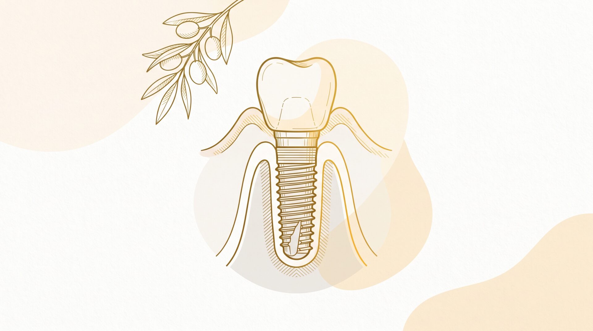 An implant crown at the gumline beside cleaning tools, showing routine maintenance after treatment.