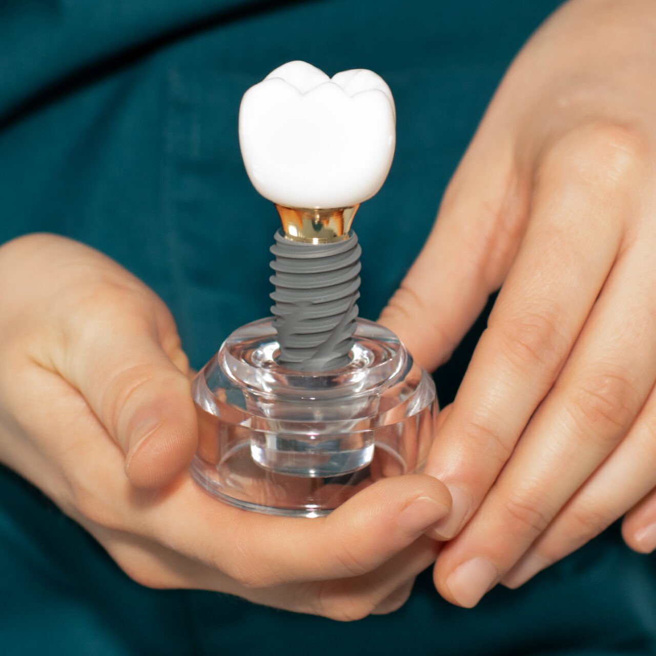 dental implants in geelong | geelong implant dentist at geelong dental centre