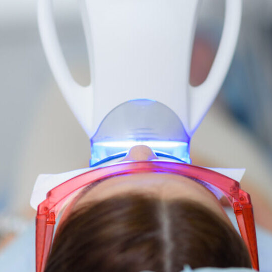 in chair teeth whitening in geelong