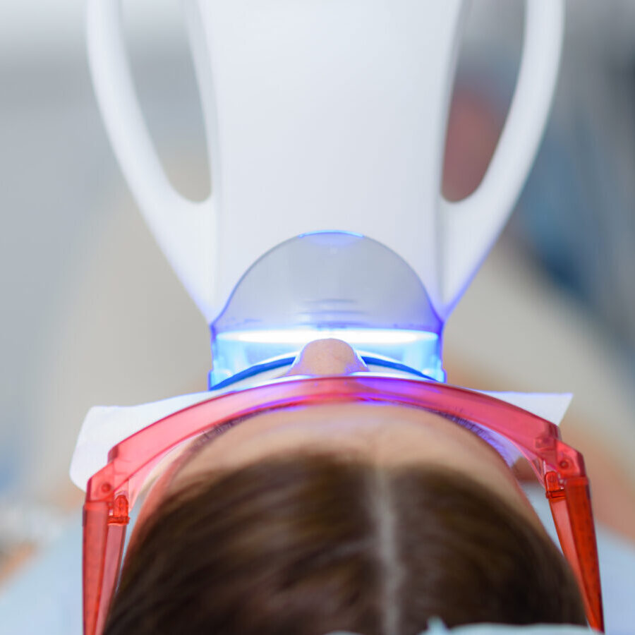 in chair teeth whitening in geelong