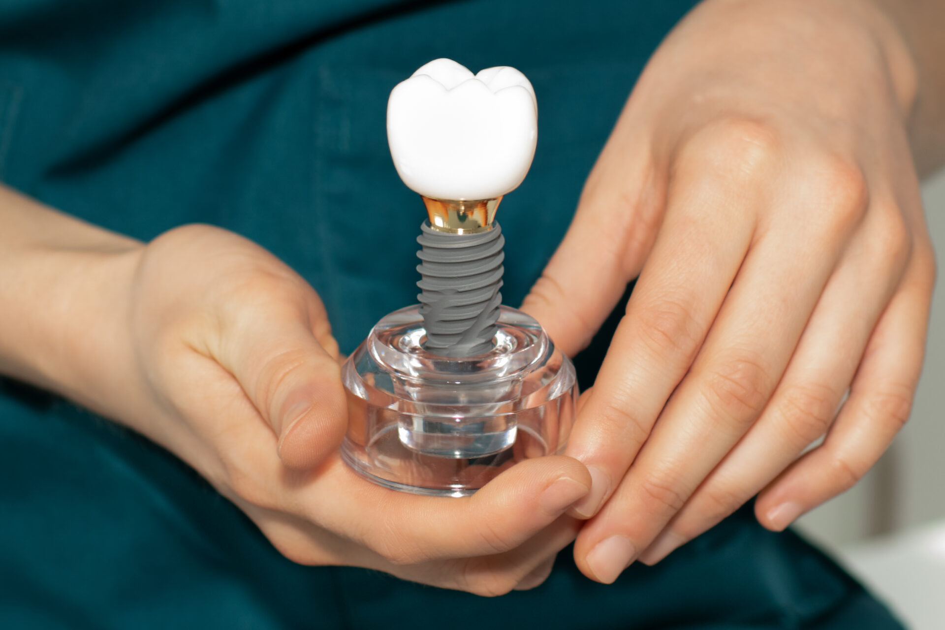 dental implants in geelong | geelong implant dentist at geelong dental centre