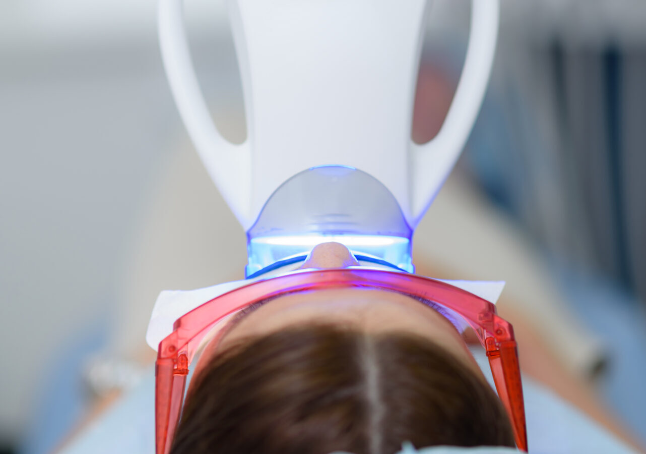 in chair teeth whitening in geelong